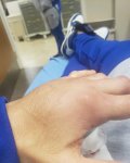 Malignaggis linkeHand.jpg