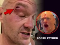 FURY TYSON - JOHN cut bleeding.jpg